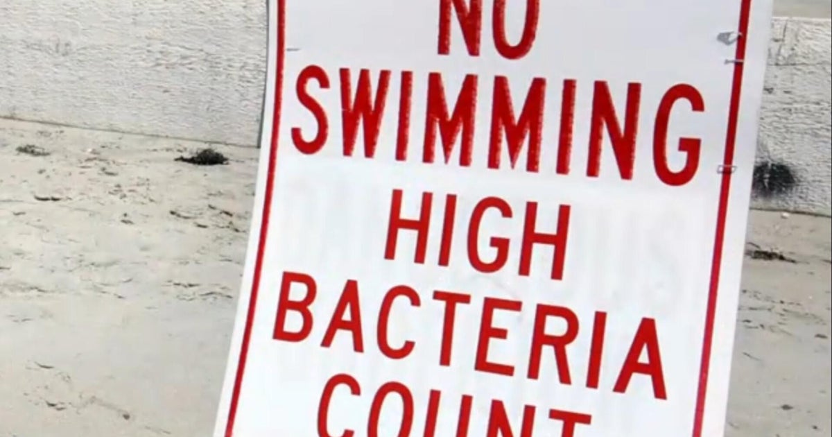 Numerous Beaches Shut Down on Labor Day Due to Bacteria Warnings